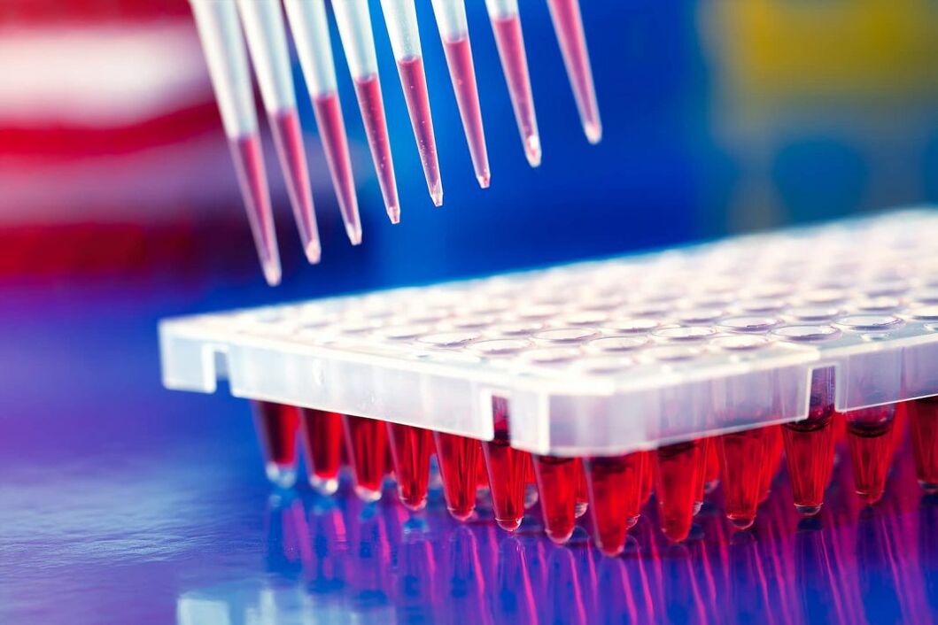 Blood tests, immunological tests for parasites