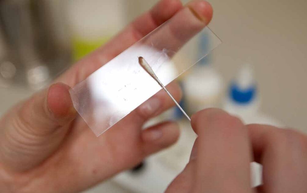 scrape to find the presence of parasites in the body