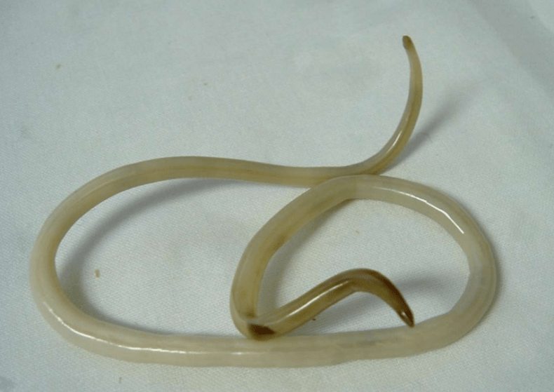 Worms from the human body and how to treat them