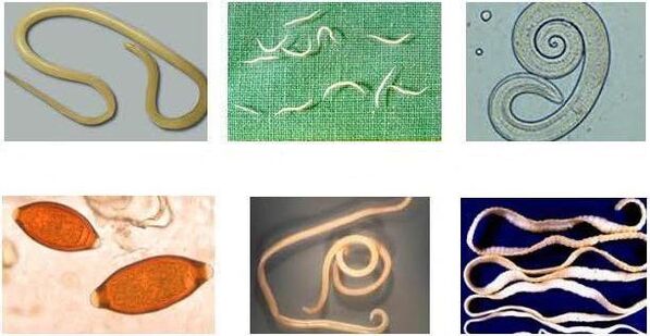 Worms can infect the human body