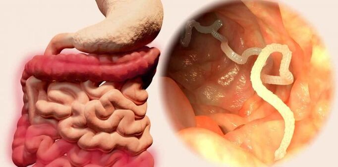 Worms are parasites in humans