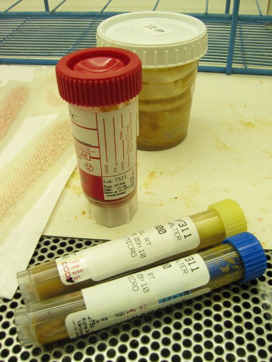 Parasite detection test